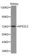 NF-E2-related factor 2 antibody, TA327023, Origene, Western Blot image 