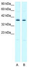 Prostaglandin E2 receptor EP3 subtype antibody, TA334750, Origene, Western Blot image 