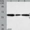 Aldo-Keto Reductase Family 1 Member A1 antibody, TA324138, Origene, Western Blot image 