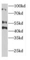 Extracellular Matrix Protein 2 antibody, FNab02627, FineTest, Western Blot image 
