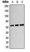 Dihydropyrimidinase Like 4 antibody, LS-C354146, Lifespan Biosciences, Western Blot image 