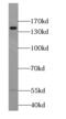 Extended Synaptotagmin 1 antibody, FNab02990, FineTest, Western Blot image 