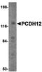 Protocadherin 12 antibody, orb75160, Biorbyt, Western Blot image 