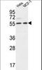 DEAD-Box Helicase 6 antibody, LS-C167343, Lifespan Biosciences, Western Blot image 