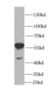 Histone deacetylase 2 antibody, FNab03796, FineTest, Western Blot image 