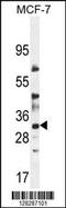 LysM Domain Containing 4 antibody, 55-171, ProSci, Western Blot image 