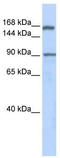 AF4/FMR2 Family Member 2 antibody, TA335215, Origene, Western Blot image 