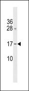 GRB2 Binding Adaptor Protein, Transmembrane antibody, PA5-49249, Invitrogen Antibodies, Western Blot image 