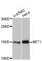 Bet1 Golgi Vesicular Membrane Trafficking Protein antibody, A07000, Boster Biological Technology, Western Blot image 