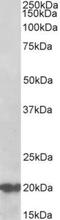 DnaJ Heat Shock Protein Family (Hsp40) Member C5 antibody, TA311460, Origene, Western Blot image 