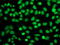 Fibroblast growth factor receptor 2 antibody, LS-C172938, Lifespan Biosciences, Immunofluorescence image 