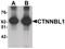 Catenin Beta Like 1 antibody, PA5-21112, Invitrogen Antibodies, Western Blot image 