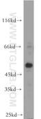 Homeobox C10 antibody, 20632-1-AP, Proteintech Group, Western Blot image 