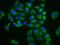 Major Facilitator Superfamily Domain Containing 4A antibody, orb422956, Biorbyt, Immunofluorescence image 