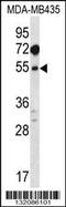 Methionine Adenosyltransferase 1A antibody, 56-593, ProSci, Western Blot image 