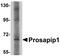 Leucine Zipper Tumor Suppressor Family Member 3 antibody, NBP1-77369, Novus Biologicals, Western Blot image 