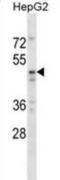 TAP Binding Protein Like antibody, abx028815, Abbexa, Western Blot image 