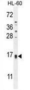 Putative T-cell leukemia/lymphoma protein 6 antibody, AP54205PU-N, Origene, Western Blot image 