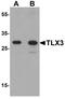 T Cell Leukemia Homeobox 3 antibody, A14535, Boster Biological Technology, Western Blot image 