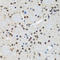 SMAD Family Member 5 antibody, LS-C331781, Lifespan Biosciences, Immunohistochemistry paraffin image 