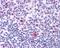 Nucleolin antibody, GTX16940, GeneTex, Immunohistochemistry paraffin image 
