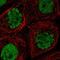 CDC Like Kinase 3 antibody, NBP1-91794, Novus Biologicals, Immunocytochemistry image 