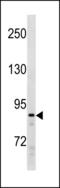 Polycomb protein SUZ12 antibody, LS-C203831, Lifespan Biosciences, Western Blot image 