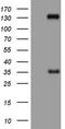 Phosphatidate phosphatase LPIN3 antibody, CF804906, Origene, Western Blot image 