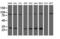 N-Ribosyldihydronicotinamide:Quinone Reductase 2 antibody, LS-C173979, Lifespan Biosciences, Western Blot image 