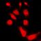 cAMP-dependent protein kinase catalytic subunit alpha antibody, orb214435, Biorbyt, Immunocytochemistry image 
