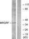 MAS Related GPR Family Member F antibody, TA316025, Origene, Western Blot image 