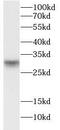 Ankyrin Repeat And SOCS Box Containing 13 antibody, FNab00620, FineTest, Western Blot image 