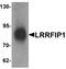 LRR Binding FLII Interacting Protein 1 antibody, orb95601, Biorbyt, Western Blot image 