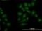 Serine/threonine-protein kinase OSR1 antibody, H00009943-M19, Novus Biologicals, Immunocytochemistry image 