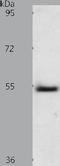 Alpha-1-B Glycoprotein antibody, TA322090, Origene, Western Blot image 
