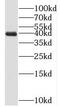 Phosphoribosyl Pyrophosphate Synthetase Associated Protein 1 antibody, FNab06825, FineTest, Western Blot image 