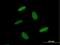 Zinc Finger Protein 557 antibody, H00079230-B01P, Novus Biologicals, Immunofluorescence image 