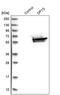Dihydropyrimidinase antibody, PA5-55183, Invitrogen Antibodies, Western Blot image 