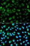 Promyelocytic Leukemia antibody, orb191472, Biorbyt, Immunofluorescence image 