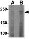 Dedicator of cytokinesis protein 8 antibody, GTX31578, GeneTex, Western Blot image 