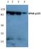 Nuclear Factor Kappa B Subunit 1 antibody, AP20731PU-N, Origene, Western Blot image 
