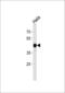 CTF antibody, PA5-35164, Invitrogen Antibodies, Western Blot image 