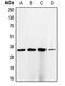 Cyclin Dependent Kinase 1 antibody, MBS821627, MyBioSource, Western Blot image 