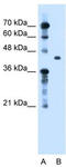 Transforming Growth Factor Beta Induced antibody, TA335225, Origene, Western Blot image 