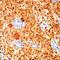 S100 Calcium Binding Protein A1 antibody, MA5-12969, Invitrogen Antibodies, Immunohistochemistry paraffin image 