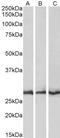 Capping Actin Protein Of Muscle Z-Line Subunit Beta antibody, LS-C54606, Lifespan Biosciences, Western Blot image 