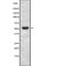 FTO Alpha-Ketoglutarate Dependent Dioxygenase antibody, abx215476, Abbexa, Western Blot image 