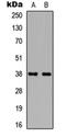 TATA-Box Binding Protein antibody, orb304622, Biorbyt, Western Blot image 
