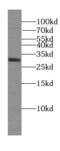 DNA Damage Regulated Autophagy Modulator 2 antibody, FNab08790, FineTest, Western Blot image 