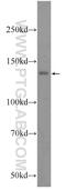 NRDE-2, Necessary For RNA Interference, Domain Containing antibody, 24968-1-AP, Proteintech Group, Western Blot image 